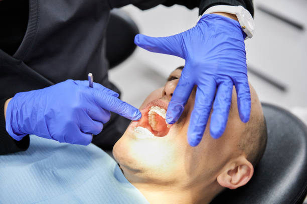 Best Emergency Treatment for Oral Infections in St Martinville, LA